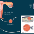 infertility_0648.png