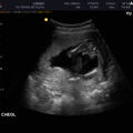 male_fetus_16wks0.jpg
