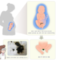 meconium_aspiration_syndrome_3421.png