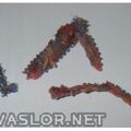 mesh-after-3-months-removed-from-liz-reece-300.jpg