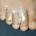 misuse_acetate010804-1.jpg