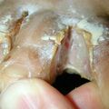 misuse_acetate010804-3.jpg