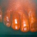 misuse_acetate9-211.jpg