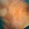 misuse_acetate9-486.jpg