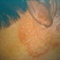 misuse_acetate9-487.jpg