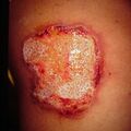 misuse_acetate9-638.jpg