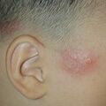 misuse_acrovin020610.jpg