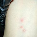 misuse_acupuncture020211-3.jpg