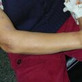 misuse_acupuncture020215-1.jpg