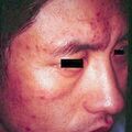 misuse_acupuncture9-810.jpg