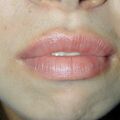 misuse_acyron020506-2.jpg