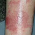misuse_advantan010627-1.jpg