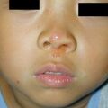 misuse_advantan020806-1.jpg