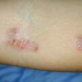 misuse_advantan020806-2.jpg