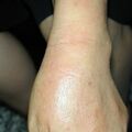 misuse_albocid020716.jpg