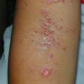 misuse_alcrovan020806-1.jpg