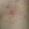 misuse_alcrovan020806-2.jpg