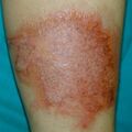 misuse_aloe011102.jpg