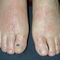 misuse_aloe020301.jpg
