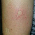 misuse_aloe020812.jpg