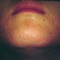 misuse_aloe9-493.jpg