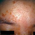 misuse_aloe9-507.jpg