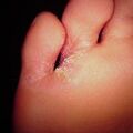 misuse_antifungal9-1072.jpg
