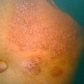 misuse_apoderm9-551.jpg