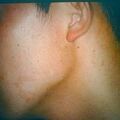 misuse_apoderm9-835.jpg