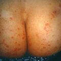 misuse_apoderm9-836.jpg
