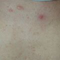 misuse_ardutec020903-2.jpg