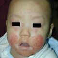 misuse_aricort020131-1.jpg