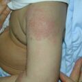 misuse_aricort020131-2.jpg