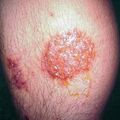 misuse_artemisia2000-188.jpg