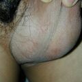 misuse_bacora011031.jpg