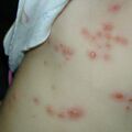 misuse_bactalg011029.jpg