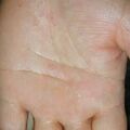 misuse_banjil010725.jpg