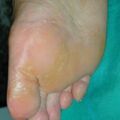misuse_banjil020617.jpg