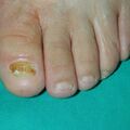 misuse_banjil020805-1.jpg