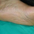 misuse_banjil020805-2.jpg