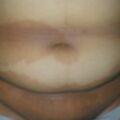 misuse_banjil020805.jpg