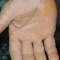 misuse_banjil020809-1.jpg