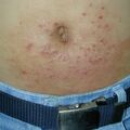 misuse_banjil020820.jpg