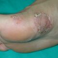 misuse_bargio020902.jpg