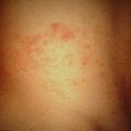 misuse_baromatil2000-304.jpg