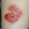 misuse_baspo020724.jpg