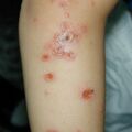 misuse_bepanten010808.jpg
