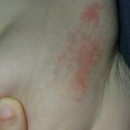misuse_bepanthen020708-2.jpg