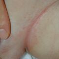 misuse_bepanthen020708-3.jpg