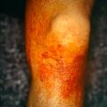 misuse_betadine9-704.jpg